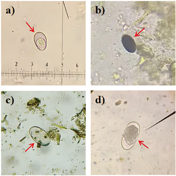 Fig 1