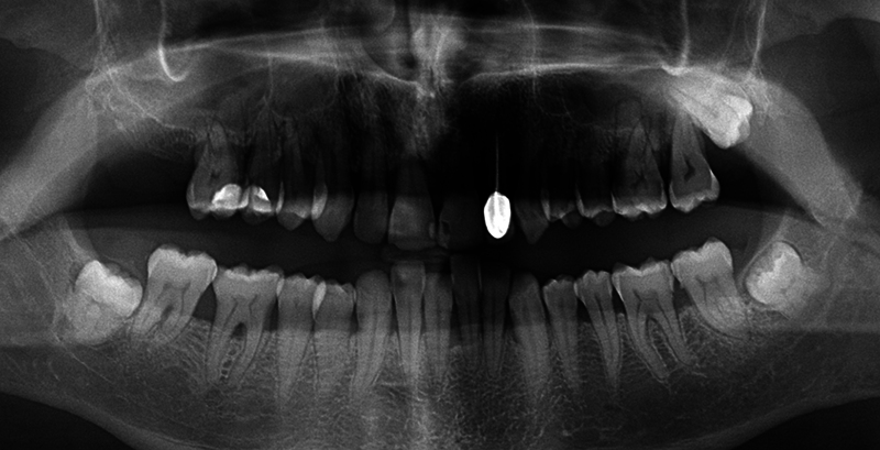 Fig. 4