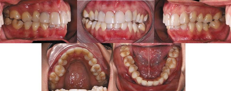 Fig. 2