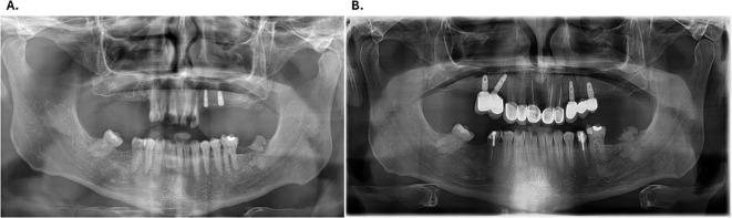 Figure 2