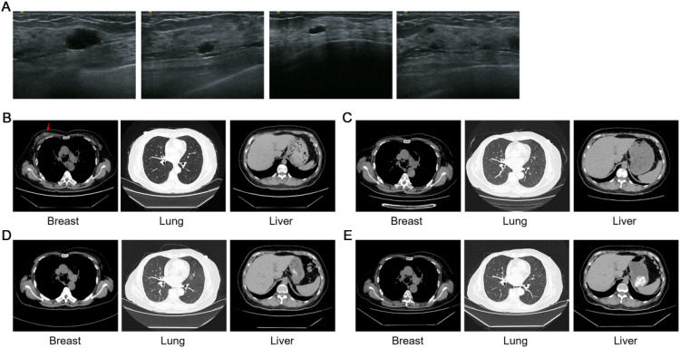 Figure 2