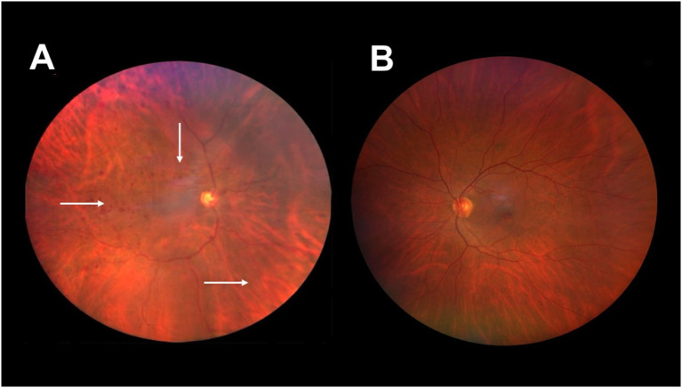 Figure 2