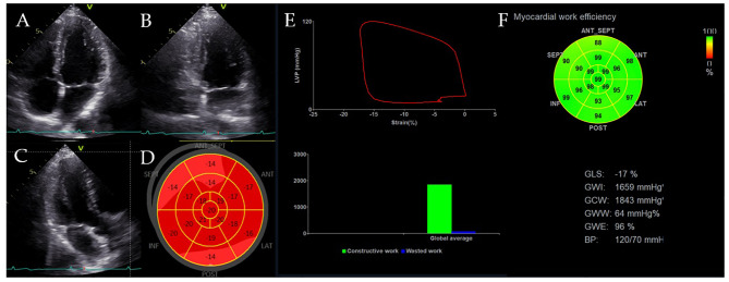 Figure 2