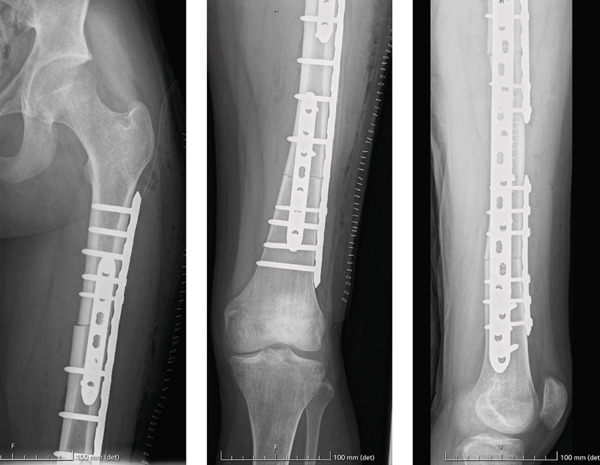 Figure 6