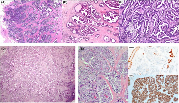 Figure 14