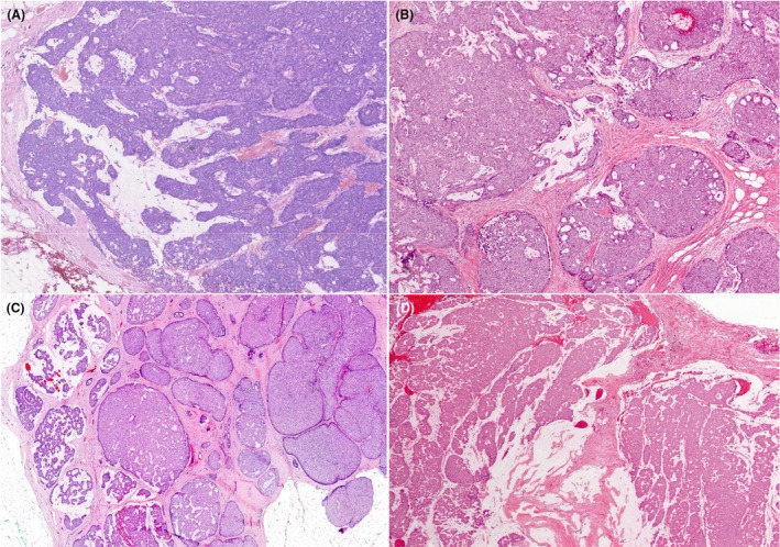 Figure 15