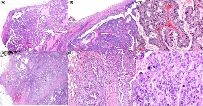 Figure 16