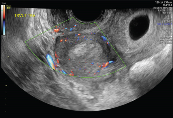 Figure 2