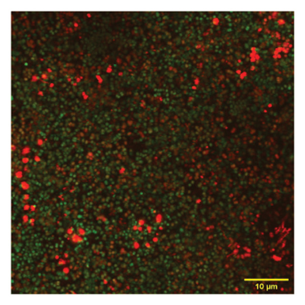 Figure 11
