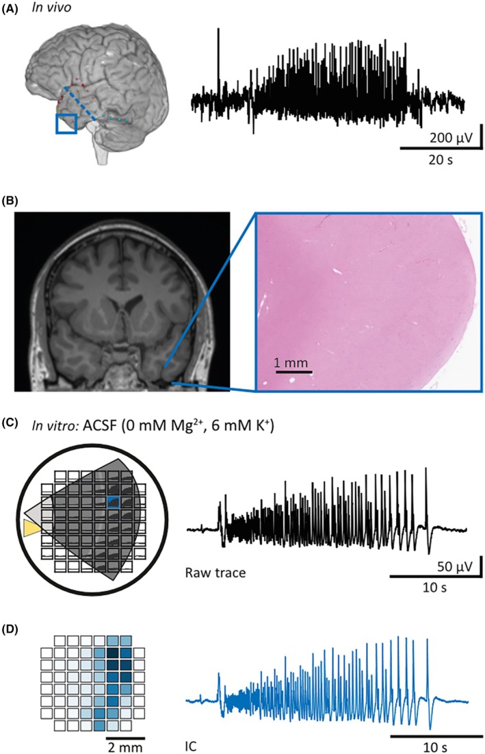 FIGURE 1