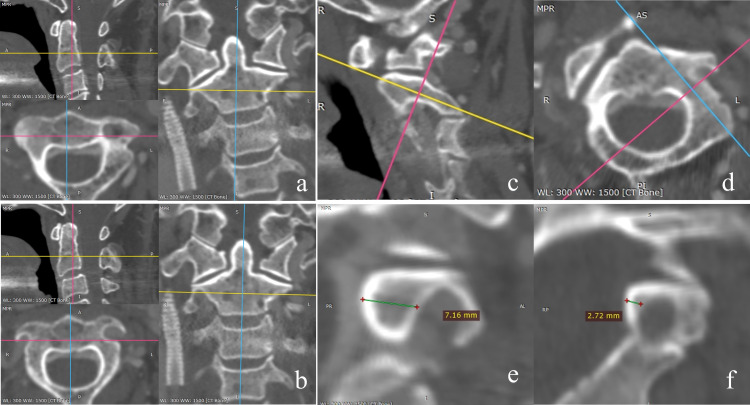 Fig 2