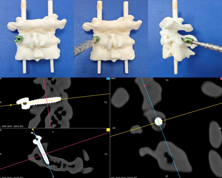 Fig 3
