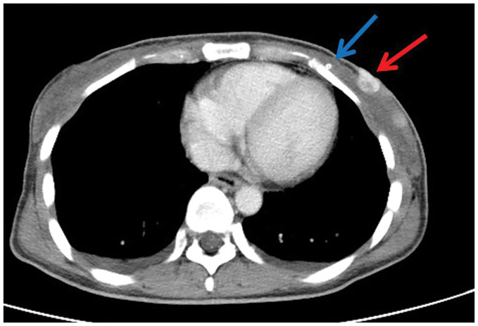 Fig. 1