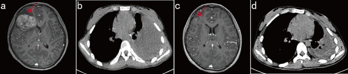 FIGURE 4