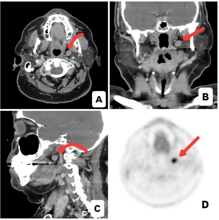 FIGURE 1