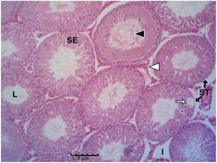 Figure 11