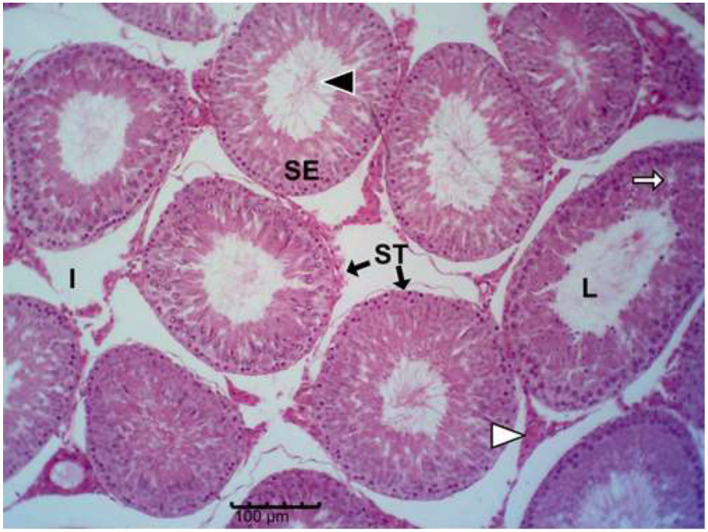 Figure 12