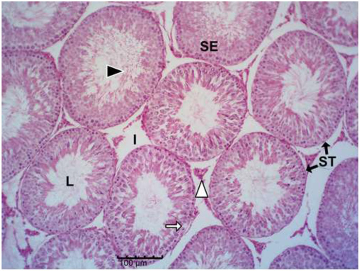 Figure 13