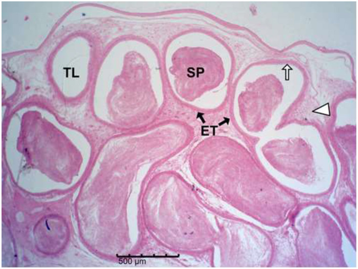 Figure 14
