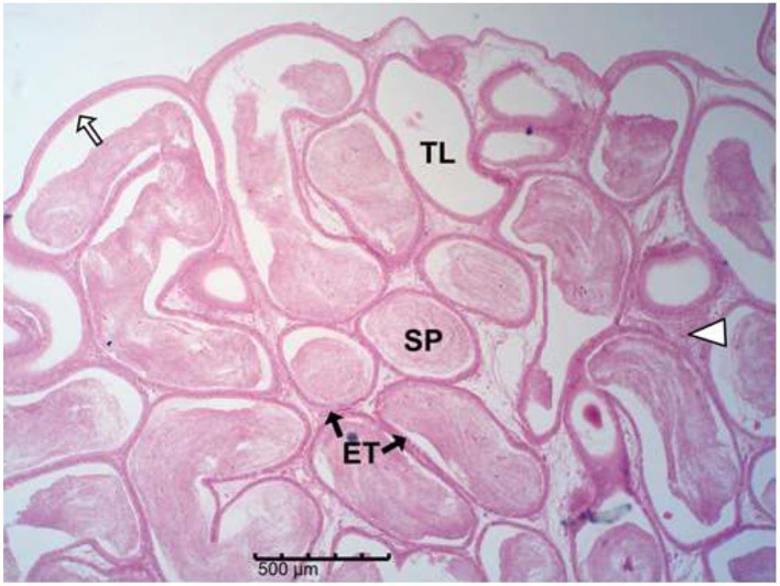 Figure 16