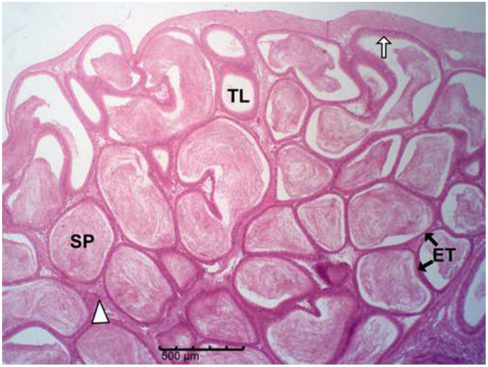 Figure 17