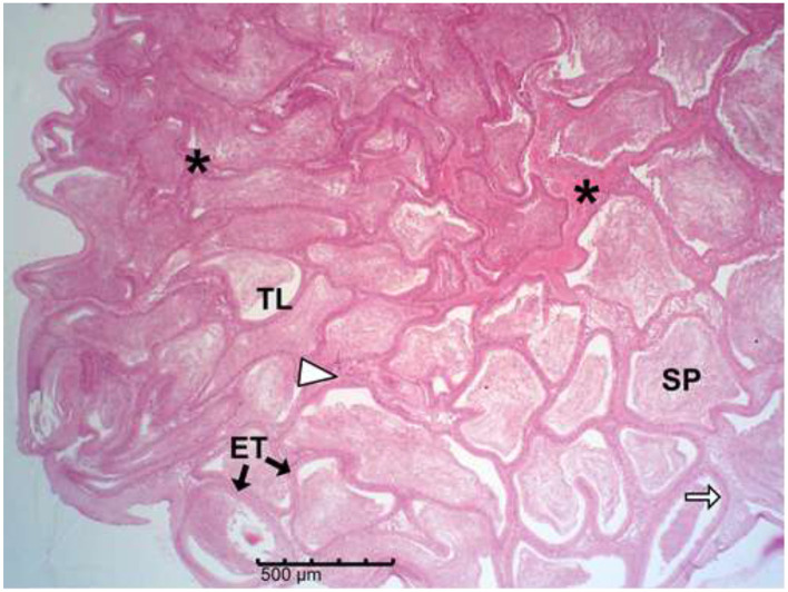 Figure 18