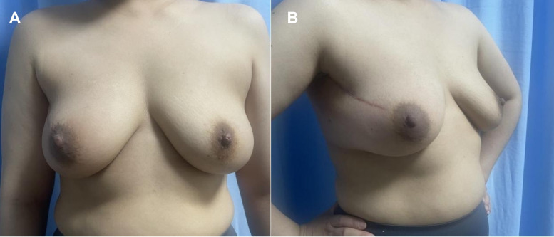 Figure 3