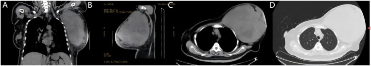 Figure 2