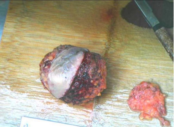Figure 3