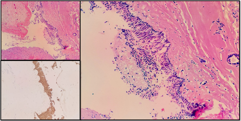 Figure 3