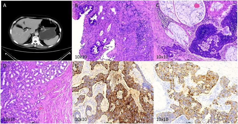 Figure 2