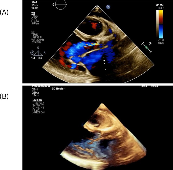 FIGURE 3
