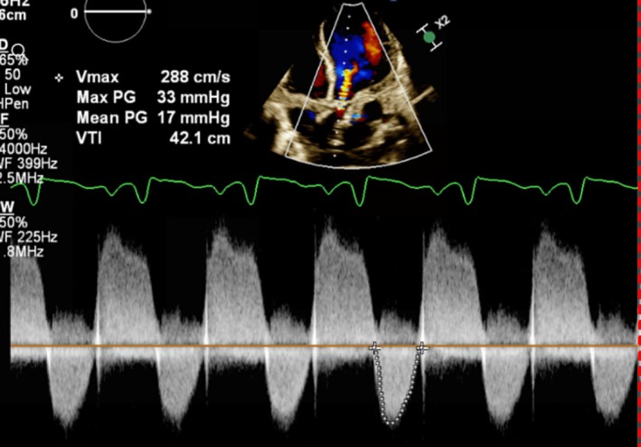 FIGURE 4