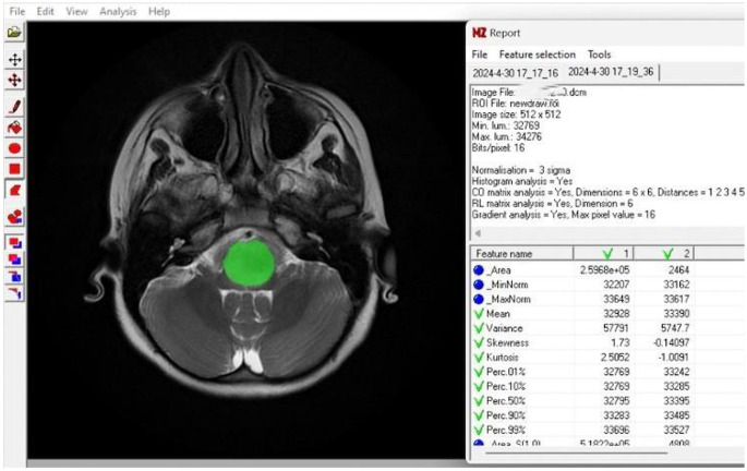 Figure 2