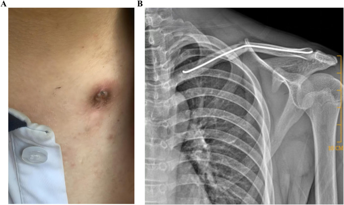 Figure 2