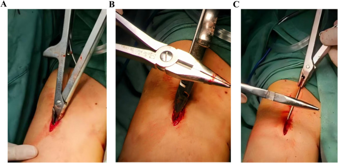 Figure 3