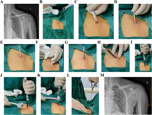 Figure 6