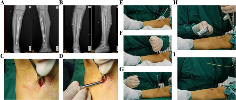 Figure 7