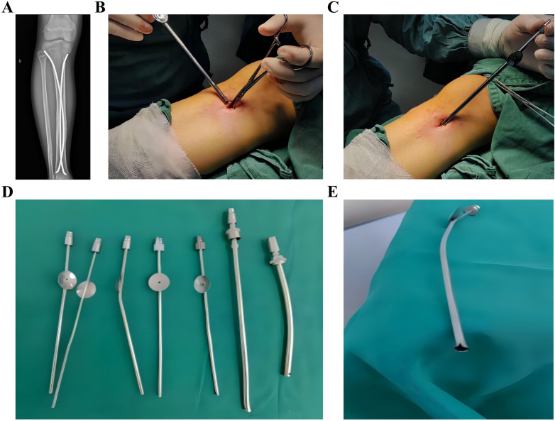 Figure 10