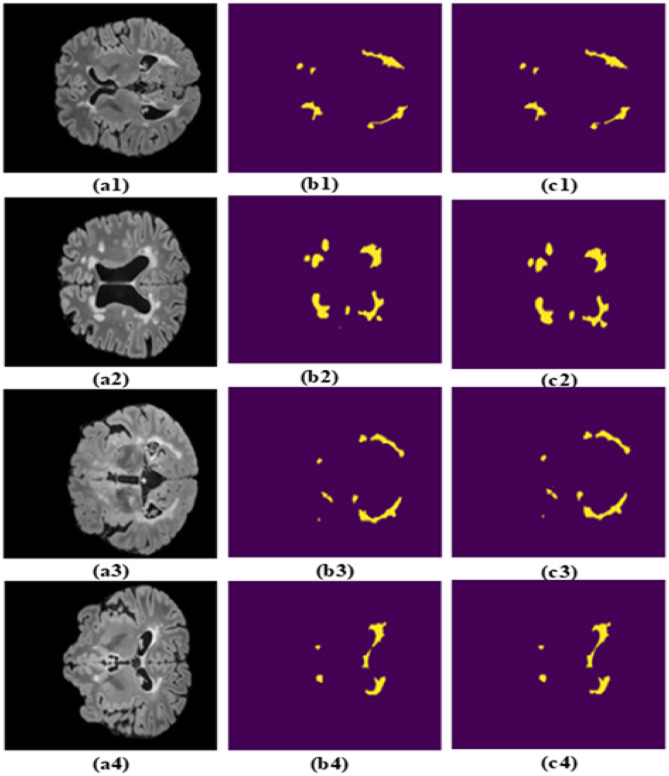 Figure 11