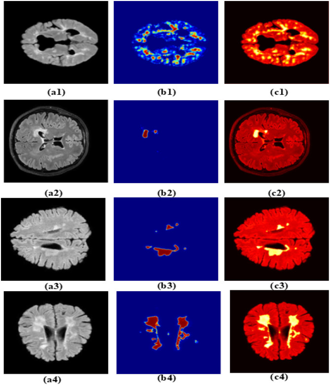 Figure 14