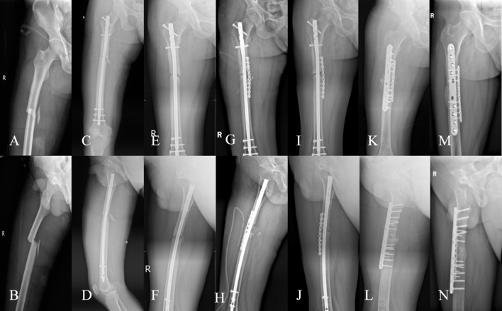 FIGURE 3