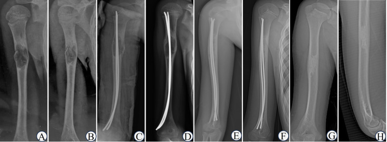 Figure 4