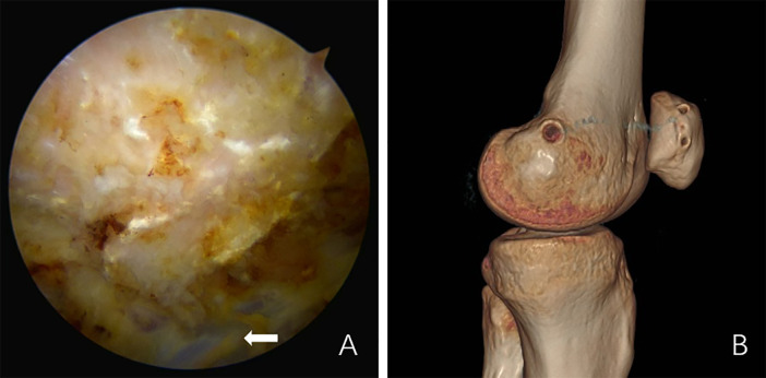 Figure 1
