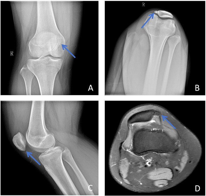 Figure 3