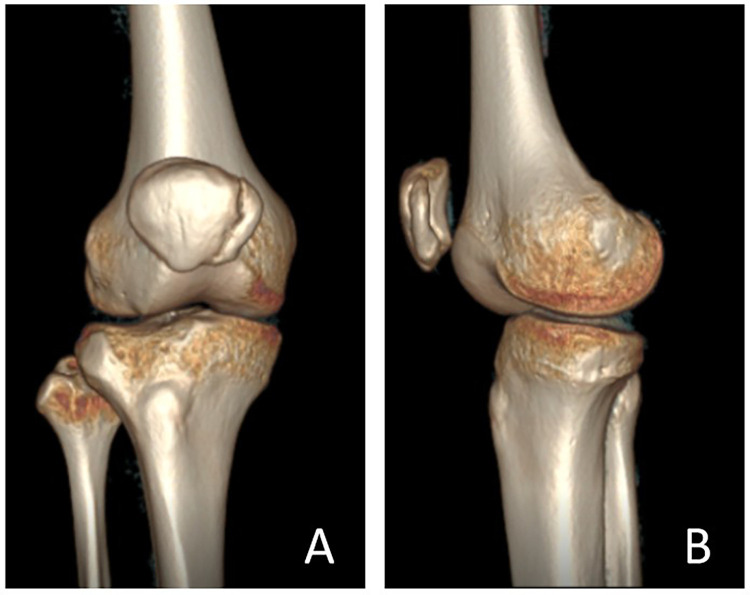 Figure 4