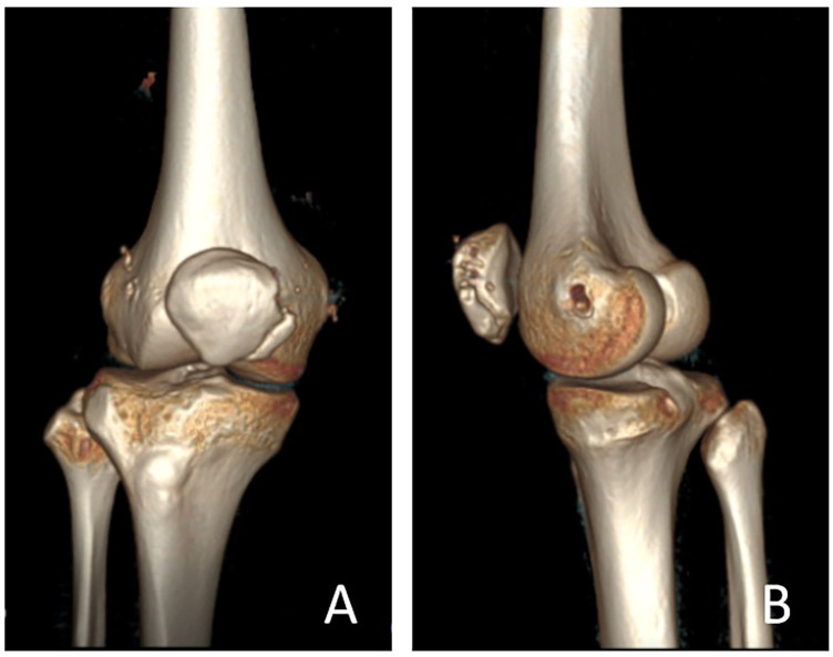 Figure 5