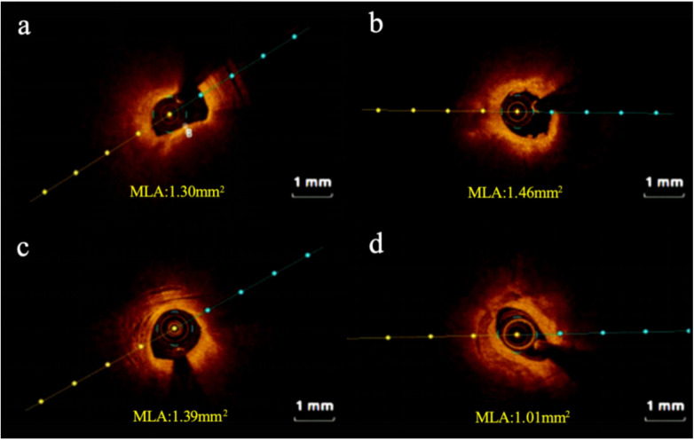 Figure 2