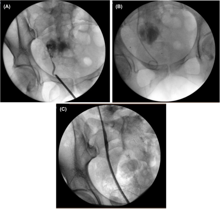FIGURE 1