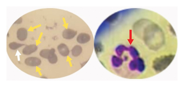 FIGURE 4